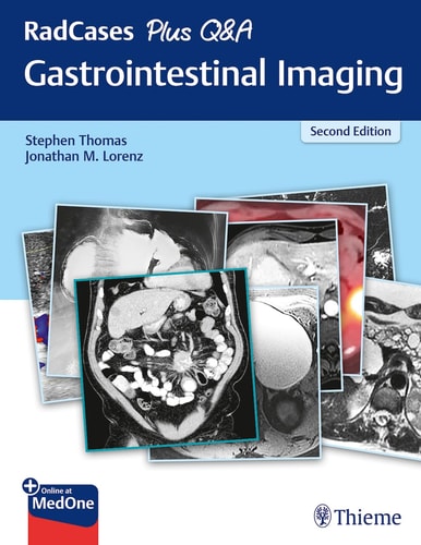 RadCases Gastrointestinal Imaging cover