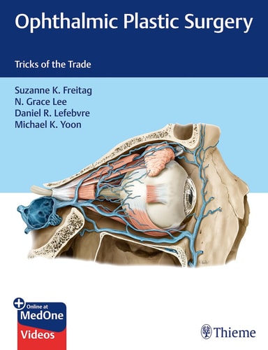 Ophthalmic Plastic Surgery Tricks of the Trade cover