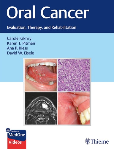 Oral Cancer Evaluation, Therapy, and Rehabilitation cover