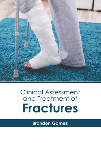 Clinical Assessment and Treatment of Fractures cover