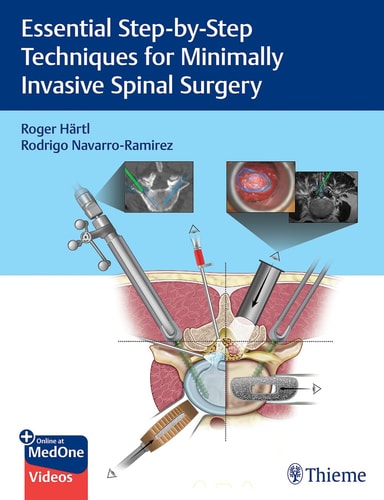 Essential Step-By-Step Techniques for Minimally Invasive Spinal Surgery cover