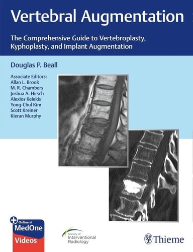 Vertebral Augmentation The Comprehensive Guide to Vertebroplasty, Kyphoplasty, and Implant Augmentation cover