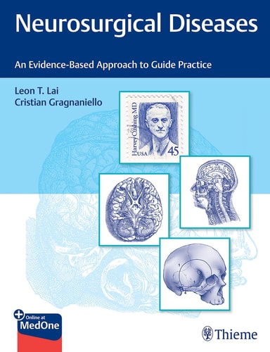 Neurosurgical Diseases An Evidence-Based Approach to Guide Practice cover