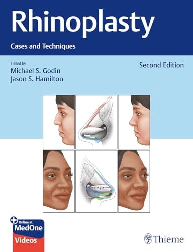Rhinoplasty Cases and Techniques cover