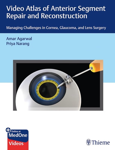 Video Atlas of Anterior Segment Repair and Reconstruction Managing Challenges in Cornea, Glaucoma, and Lens Surgery cover