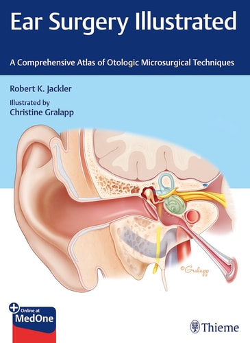 Ear Surgery Illustrated A Comprehensive Atlas of Otologic Microsurgical Techniques cover