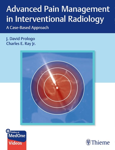 Advanced Pain Management in Interventional Radiology A Case-Based Approach cover