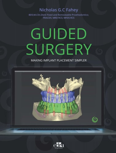 Guided Surgery. Making Implant Placement Simpler cover