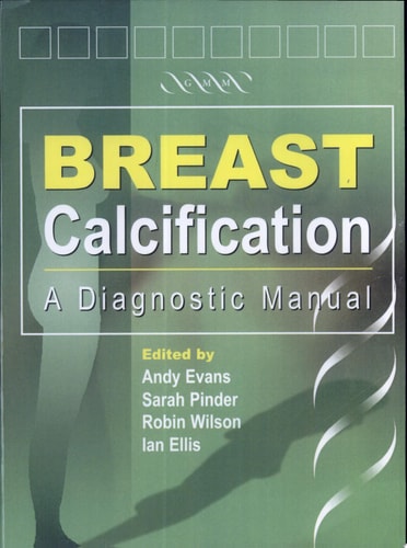 Breast Calcification A Diagnostic Manual cover