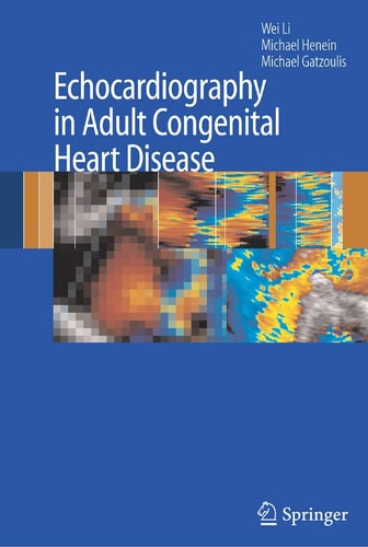 Echocardiography in Adult Congenital Heart Disease cover