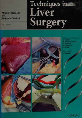 Techniques in Liver Surgery cover