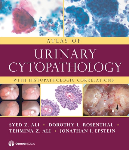 Atlas of Urinary Cytopathology With Histopathologic Correlations cover