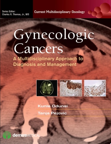 Gynecologic Cancers A Multidisciplinary Approach to Diagnosis and Management cover
