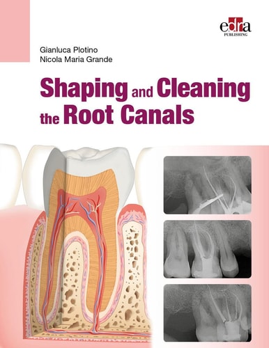Shaping and Cleaning the Root Canals cover