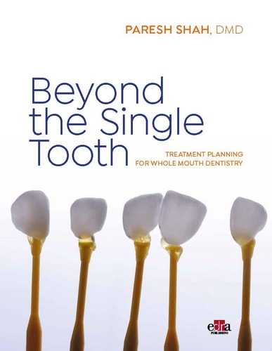 Beyond the Single Tooth Treatment Planning for Whole Mouth Dentistry cover
