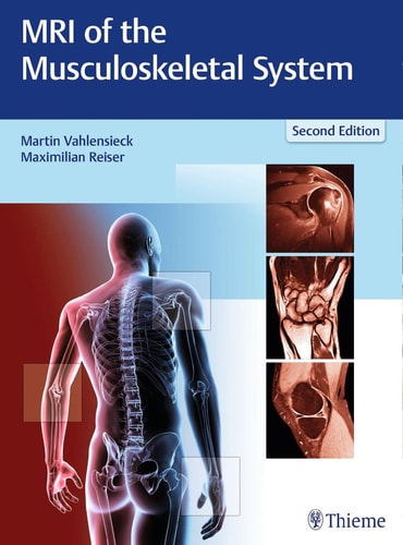 MRI of the Musculoskeletal System cover
