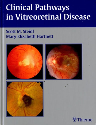 Clinical Pathways in Vitreoretinal Disease cover