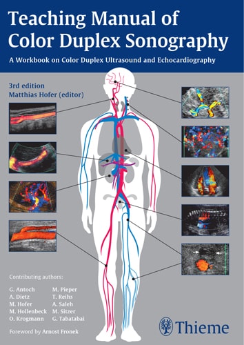 Teaching Manual of Color Duplex Sonography A Workbook on Color Duplex Ultrasound and Echocardiography cover