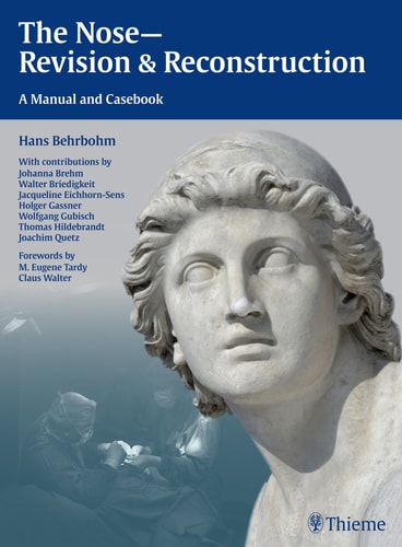 The Nose-revision & Reconstruction A Manual and Casebook cover