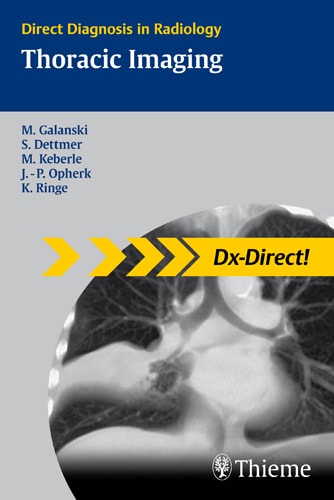 Thoracic Imaging cover