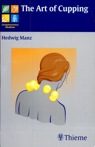 The Art of Cupping cover