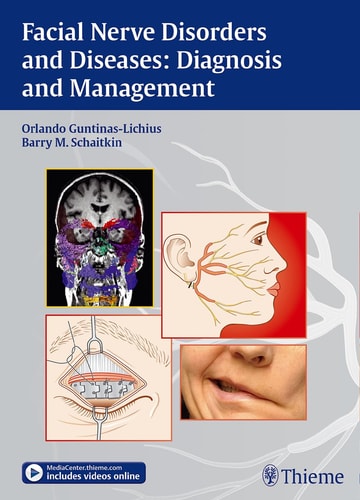 Facial Nerve Disorders and Diseases Diagnosis and Management cover