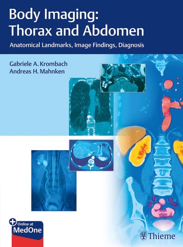 Body Imaging: Thorax and Abdomen Anatomical Landmarks, Image Findings, Diagnosis cover
