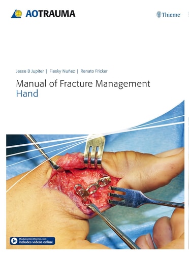 Manual of Fracture Management - Hand cover