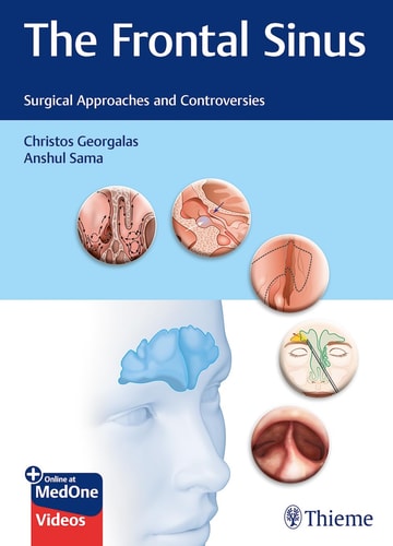 The Frontal Sinus Surgical Approaches and Controversies cover