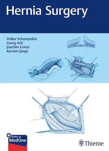 Hernia Surgery cover