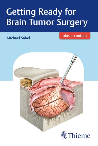 Getting Ready for Brain Tumor Surgery cover