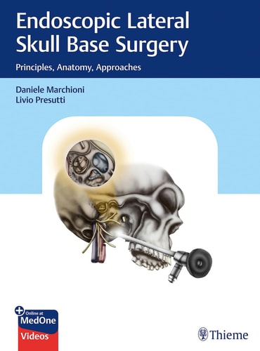 Endoscopic Lateral Skull Base Surgery Principles, Anatomy, Approaches cover