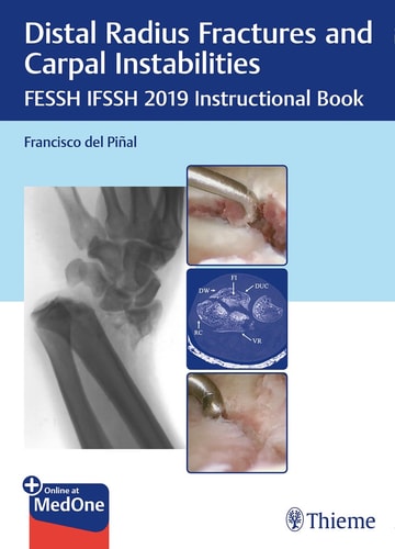 Distal Radius Fractures and Carpal Instabilities FESSH IFSSH 2019 Instructional Book cover