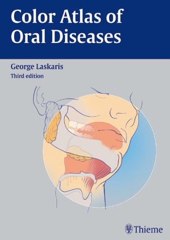 Color Atlas of Oral Diseases cover