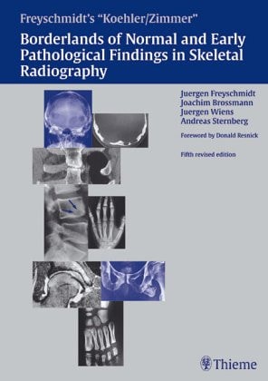 Borderlands of normal and early pathologic findings in skeletal radiography cover