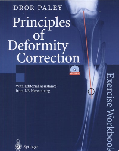 Principles of Deformity Correction Exercise Workbook cover