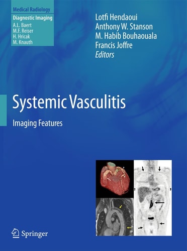 Systemic Vasculitis Imaging Features cover