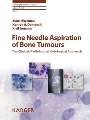 Fine Needle Aspiration of Bone Tumours The Clinical, Radiological, Cytological Approach cover