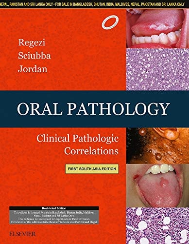 Oral Pathology: Clinical Pathologic Correlations: First South Asia Edition cover