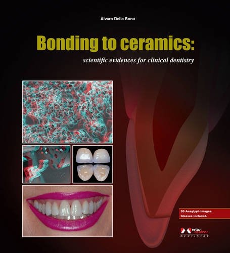 Bonding to Ceramics Scientific Evidences for Clinical Dentistry cover