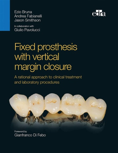 Fixed Prosthesis with Vertical Margin Closure. A Rational Approach to Clinical Treatment and Laboratory Procedures cover