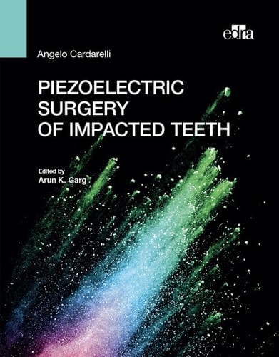 Piezoelectric Surgery of Impacted Teeth cover