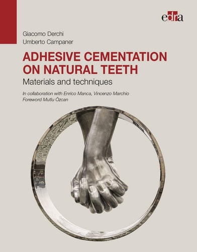 Adhesive Cementation on Natural Teeth. Materials and Techniques cover