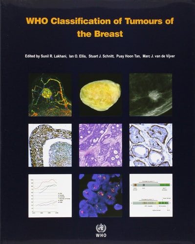 WHO Classification of Tumours of the Breast cover
