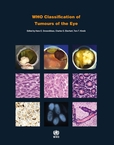 WHO Classification of Tumours of the Eye WHO Classification of Tumours, Volume 12 cover