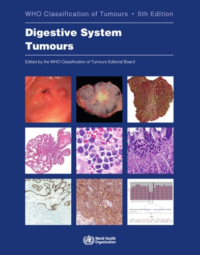 WHO Classification of Tumours. Digestive System Tumours WHO Classification of Tumours, Volume 1 cover