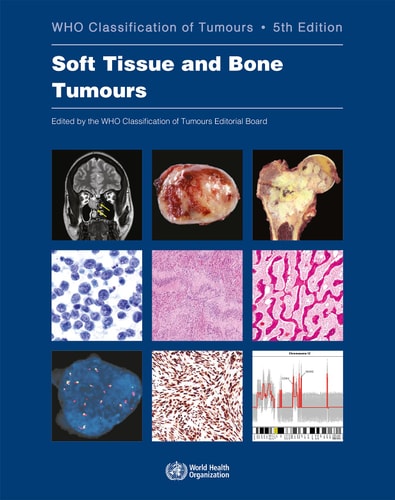 Soft Tissue and Bone Tumours cover