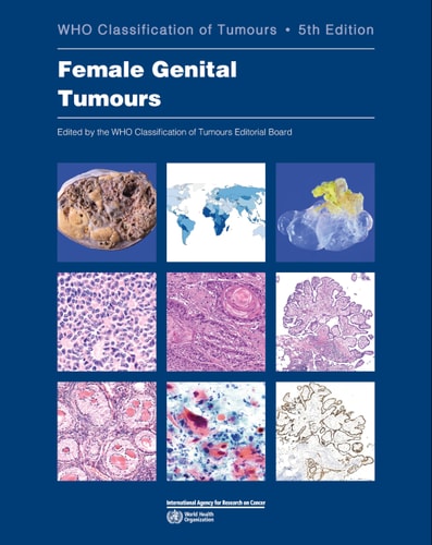 Female Genital Tumours cover
