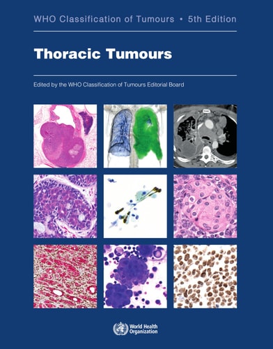 Thoracic Tumours cover