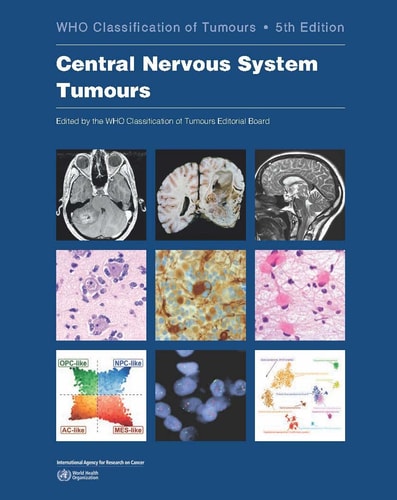 Central Nervous System Tumours cover
